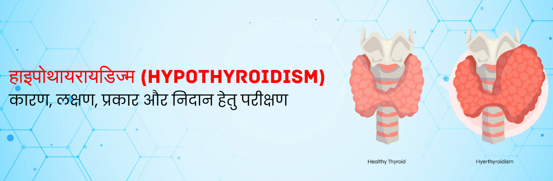 हाइपोथायरायडिज्म: कारण, लक्षण, प्रकार और निदान हेतु परीक्षण